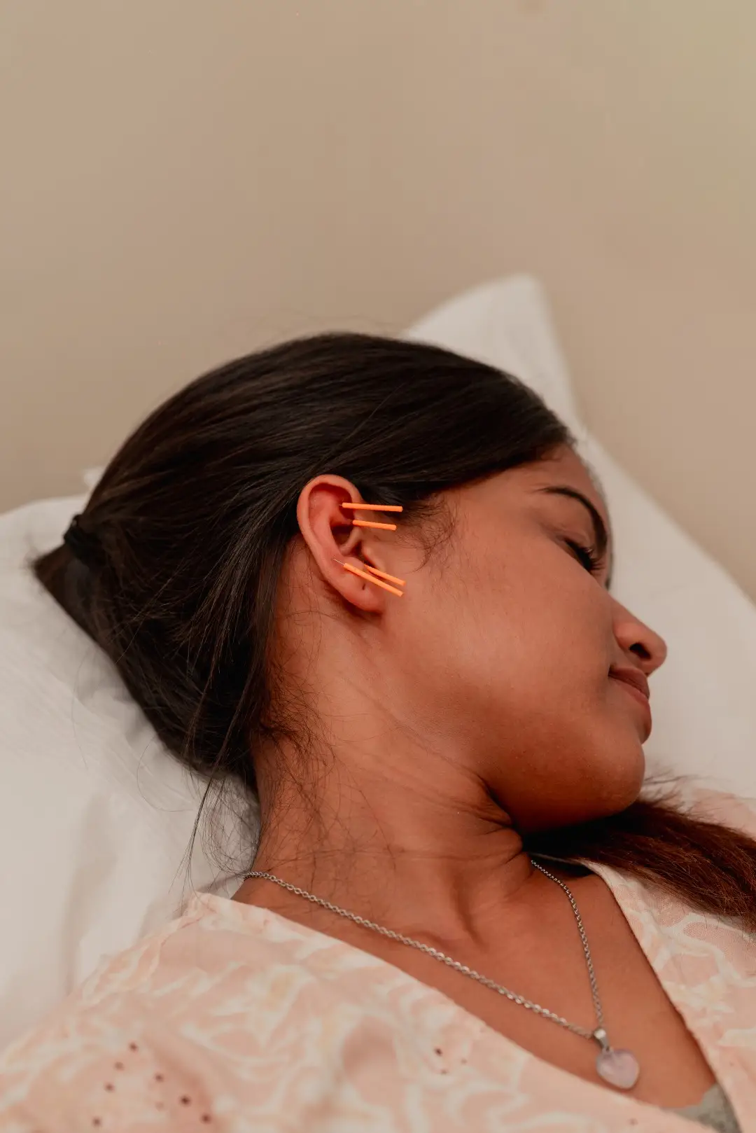 Woman resting during a gentle acupuncture session