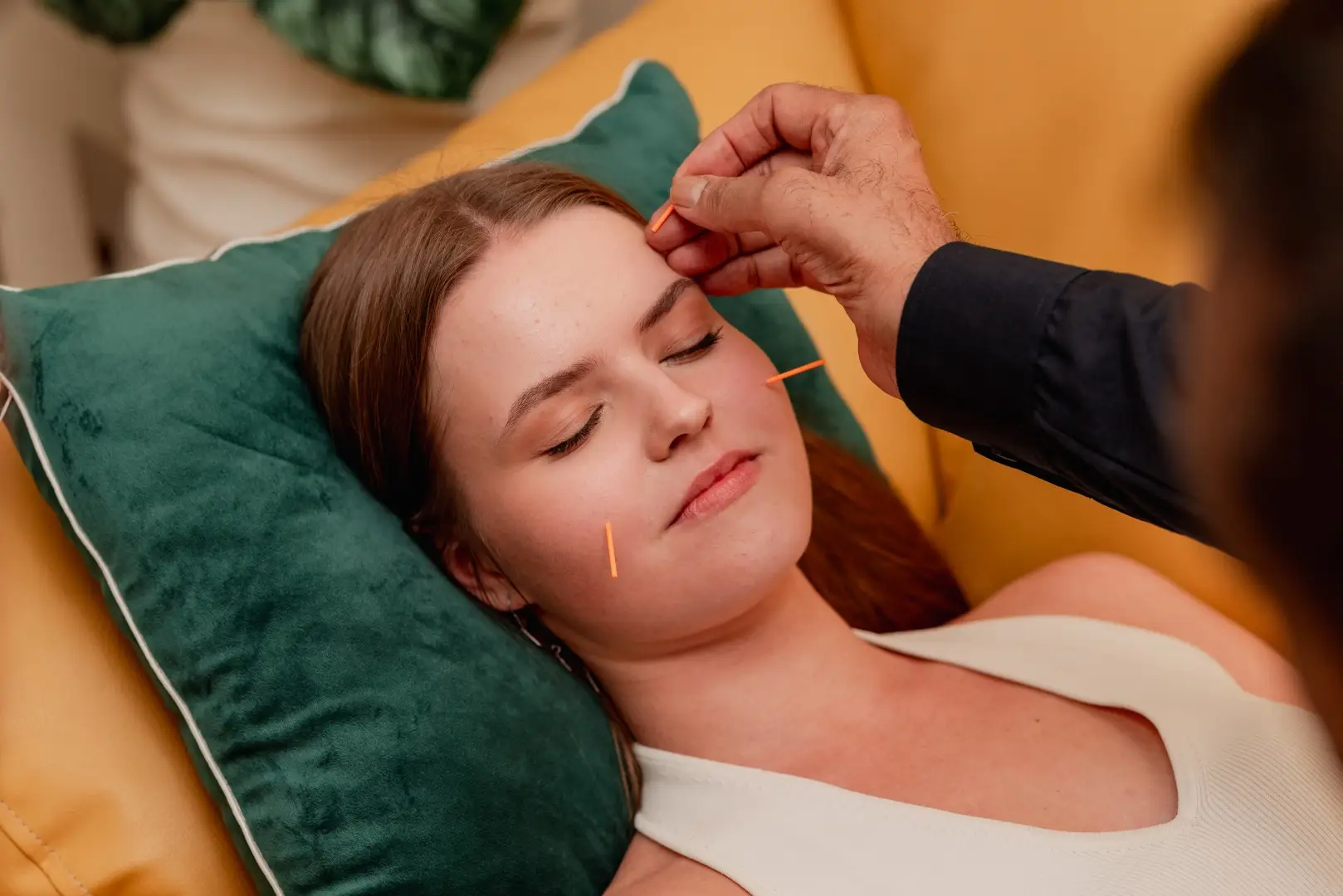 Practitioner carefully placing an acupuncture needle