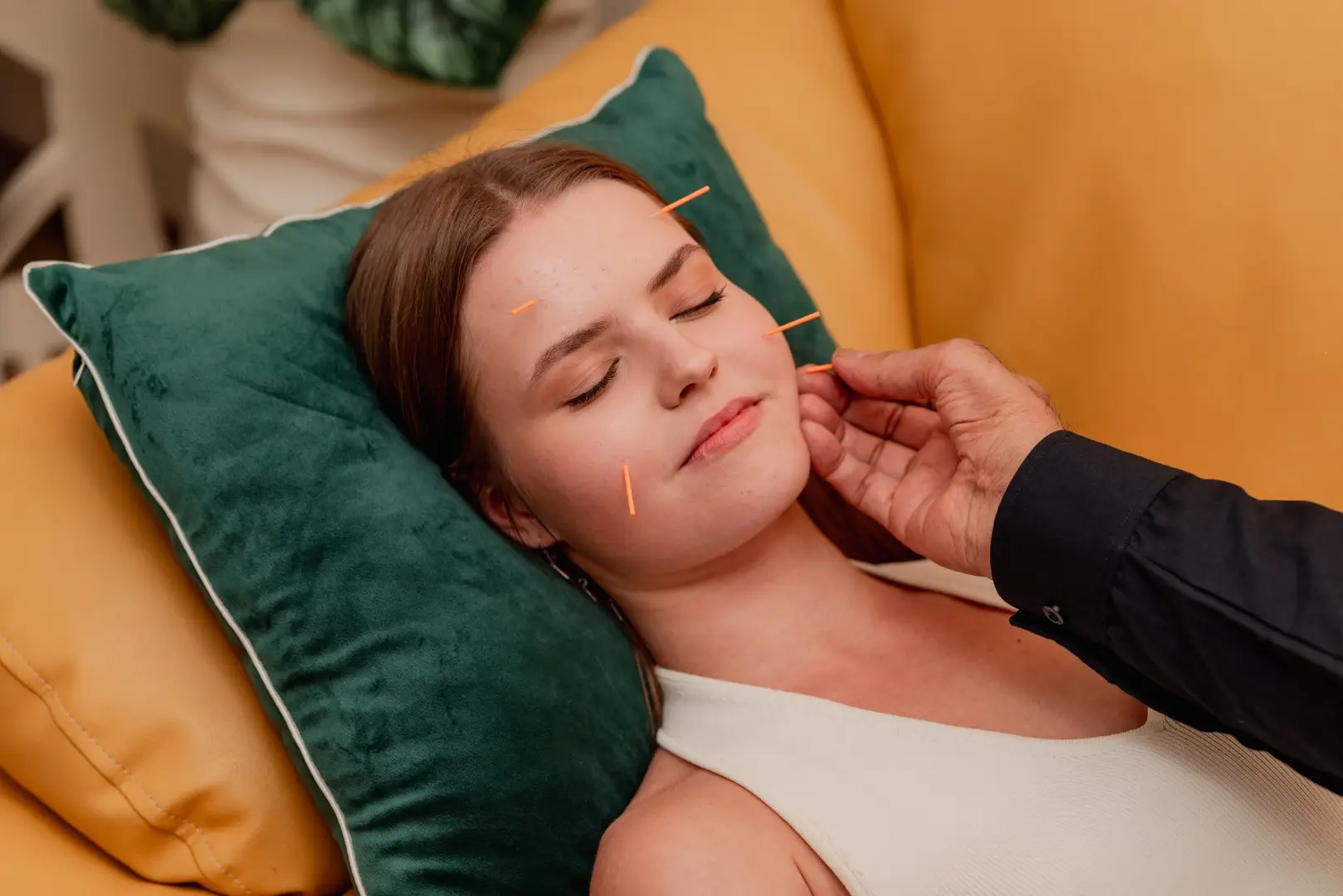 Guest relaxing with acupuncture needles placed around the face
