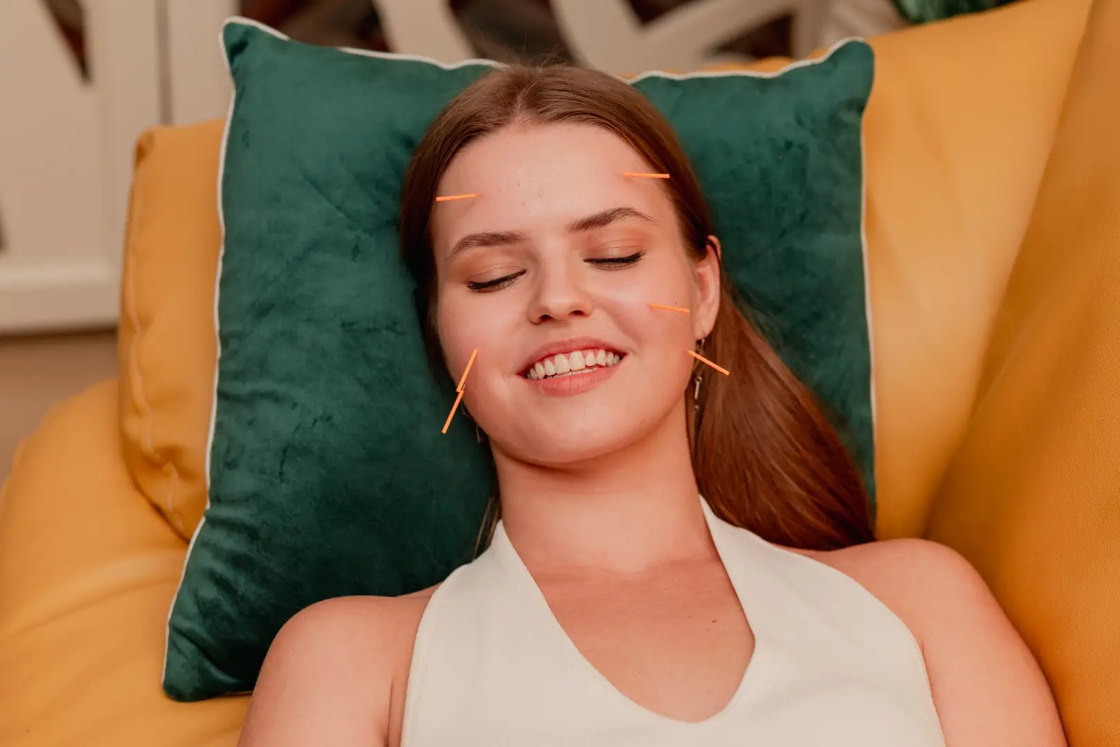 Woman resting comfortably during an acupuncture treatment