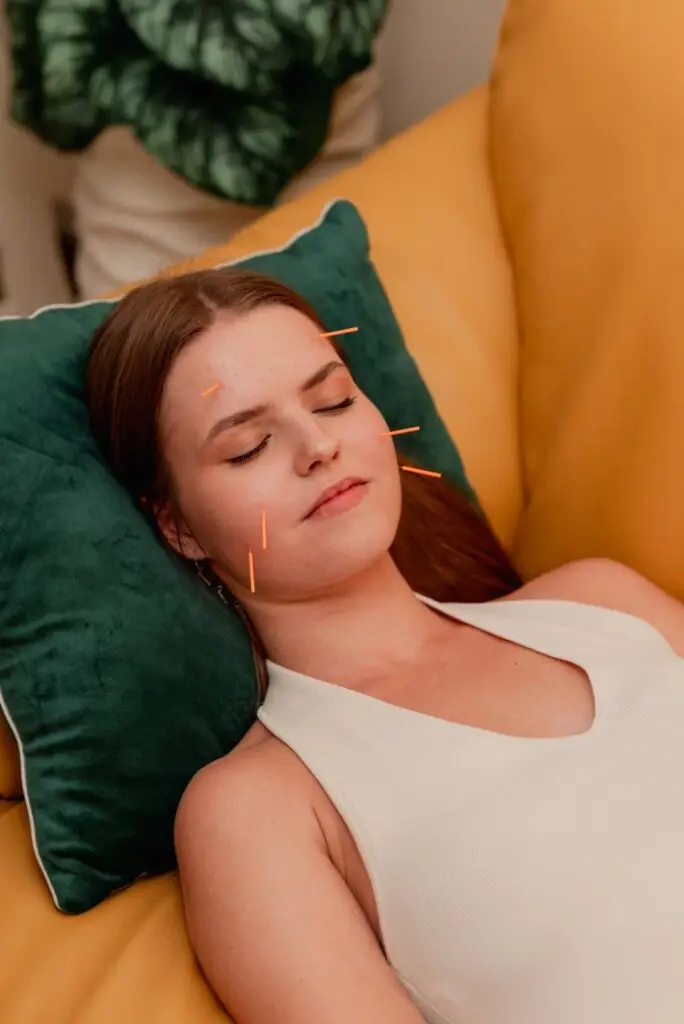 Guest relaxing during a personalised acupuncture treatment