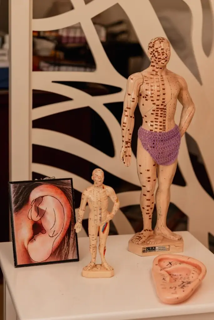 Acupuncture anatomy model used during a wellness consultation